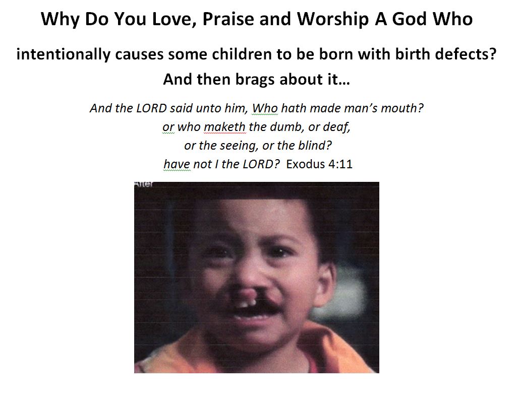 Why Do You Love 3 - Birth Defects