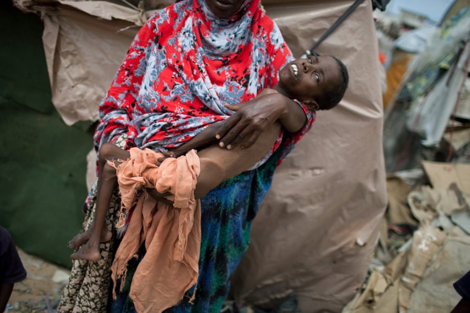 Somalian Child in mothers arms dying of starvation